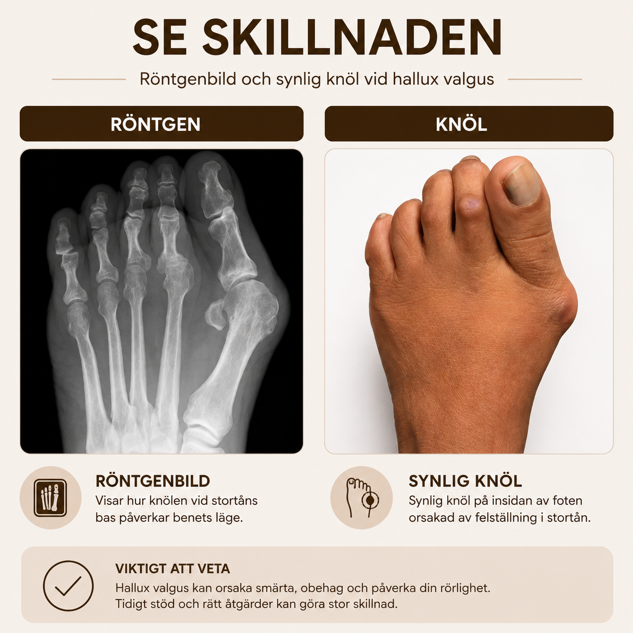 TåRak™ – Rakare tår utan smärta